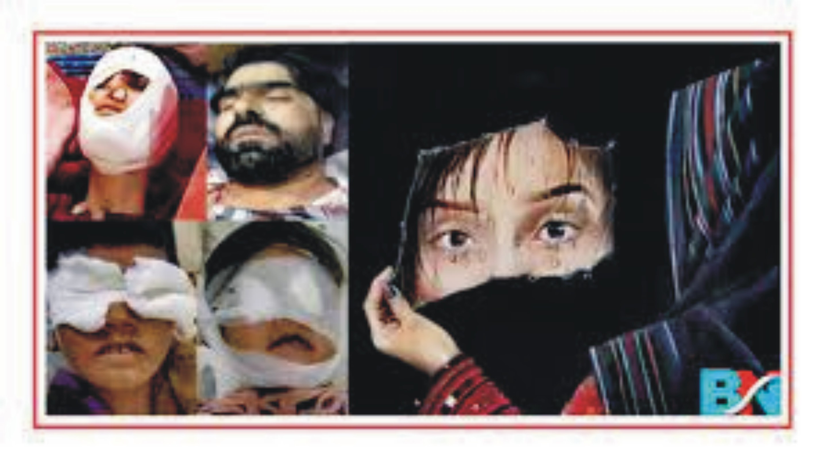 News image thumbnail