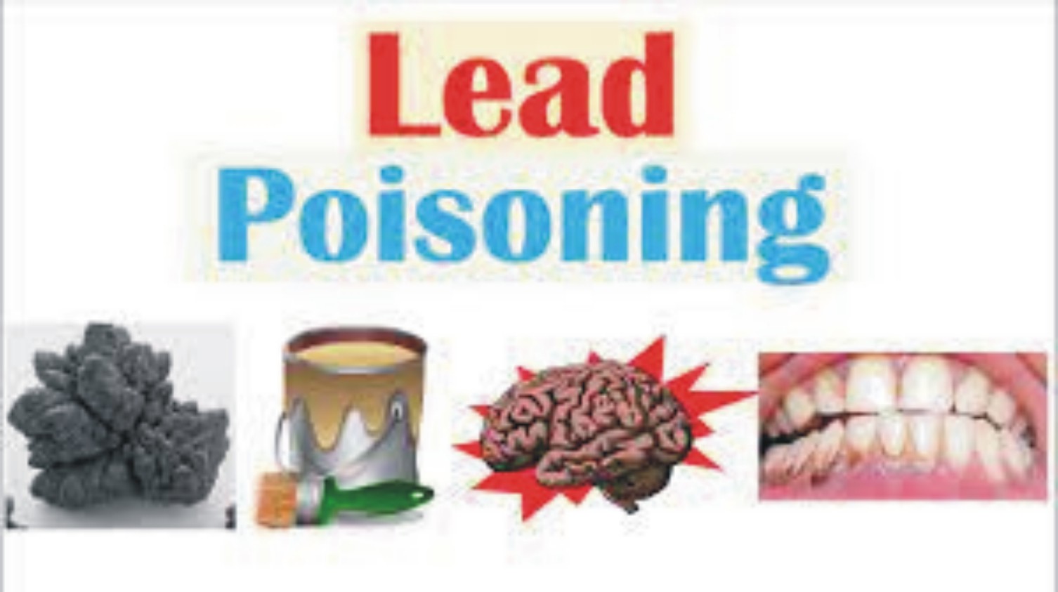 News image thumbnail