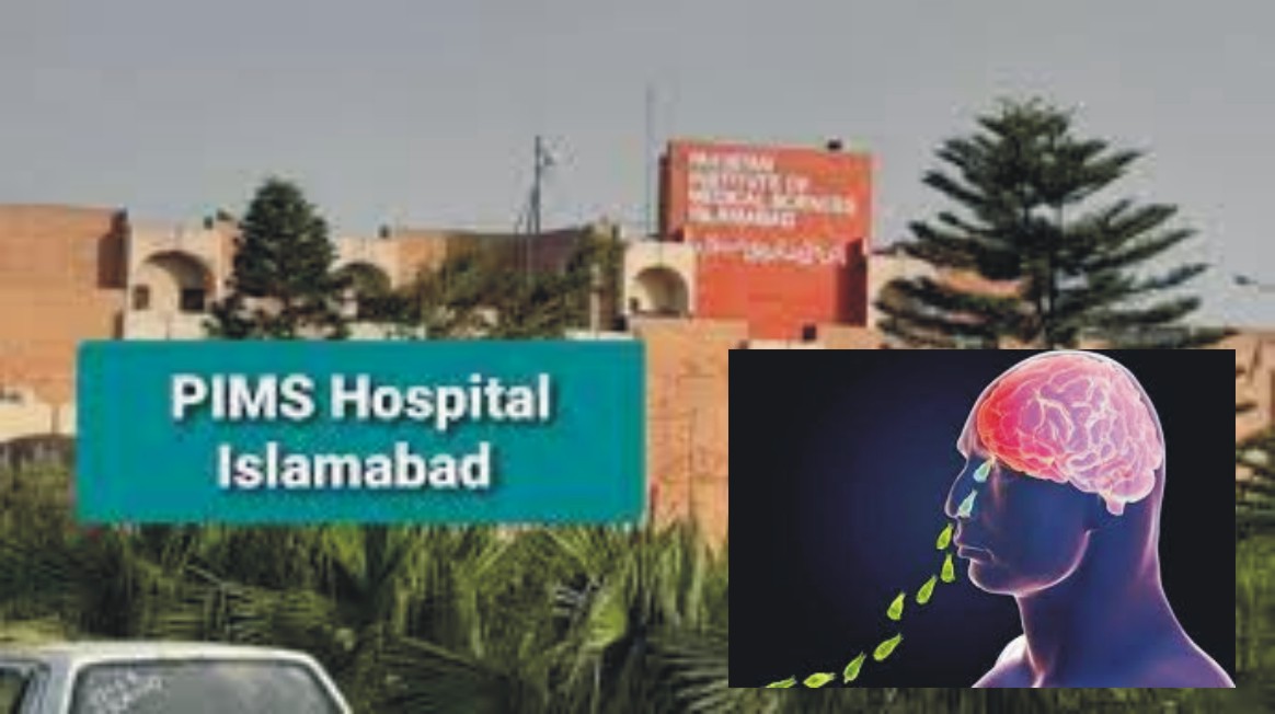 News image thumbnail